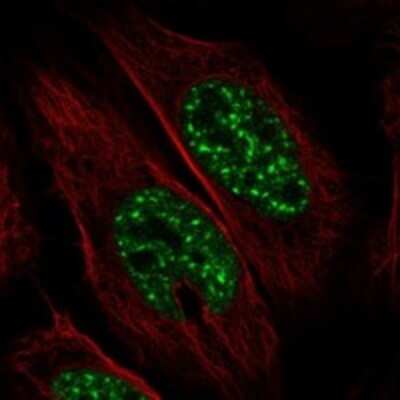 Immunocytochemistry/Immunofluorescence: SCAND1 Antibody [NBP3-17765] - Staining of human cell line U-2 OS shows localization to nuclear speckles.