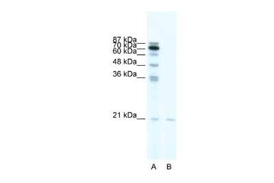 Western Blot: SCAND1 Antibody [NBP2-85693] - WB Suggested Anti-SCAND1 Antibody Titration: 0.2-1 ug/ml. ELISA Titer: 1:62500. Positive Control: HepG2 cell lysateSCAND1 is supported by BioGPS gene expression data to be expressed in HepG2