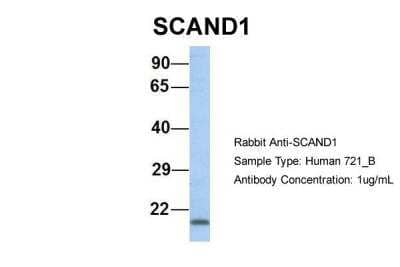 Western Blot: SCAND1 Antibody [NBP2-85695] - Host: Rabbit. Target Name: SCAND1. Sample Type: Human 721_B. Antibody Dilution: 1.0ug/mlSCAND1 is supported by BioGPS gene expression data to be expressed in 721_B