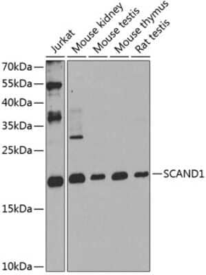 Western Blot: SCAND1 Antibody [NBP2-94906] - Analysis of extracts of various cell lines, using SCAND1 . Exposure time: 90s.