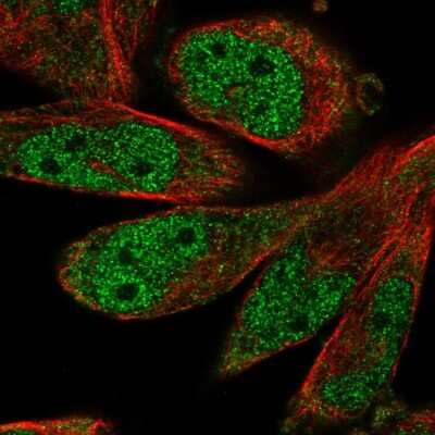 Immunocytochemistry/Immunofluorescence: SCAPER Antibody [NBP2-56827] - Staining of human cell line RH-30 shows localization to nucleoplasm & cytosol.