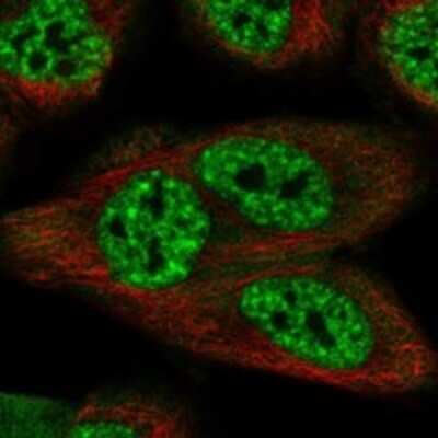 Immunocytochemistry/Immunofluorescence: SCAPER Antibody [NBP3-17308] - Staining of human cell line HAP1 shows localization to nucleoplasm & nuclear speckles.