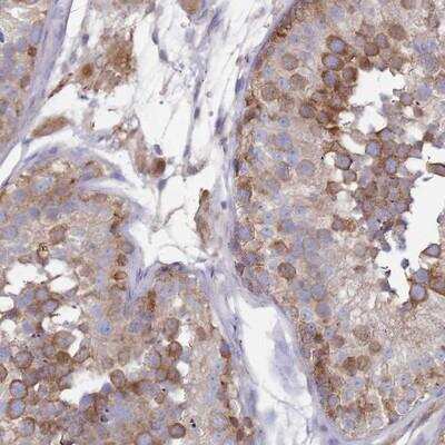 Immunohistochemistry-Paraffin: SCAPER Antibody [NBP2-13285] - Staining of human testis shows strong cytoplasmic positivity in cells in seminiferus ducts.