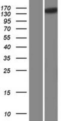 Western Blot: SCAPER Overexpression Lysate (Adult Normal) [NBP2-10240] Left-Empty vector transfected control cell lysate (HEK293 cell lysate); Right -Over-expression Lysate for SCAPER.