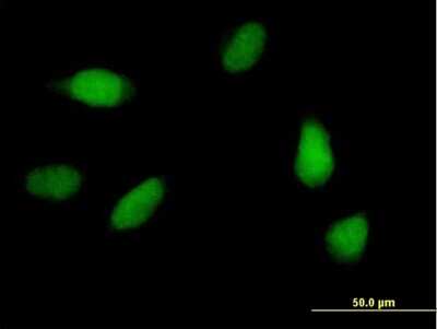 Immunocytochemistry/Immunofluorescence: SCC112 Antibody [H00023244-B01P] - Analysis of purified antibody to SCC-112 on HeLa cell. (antibody concentration 10 ug/ml)