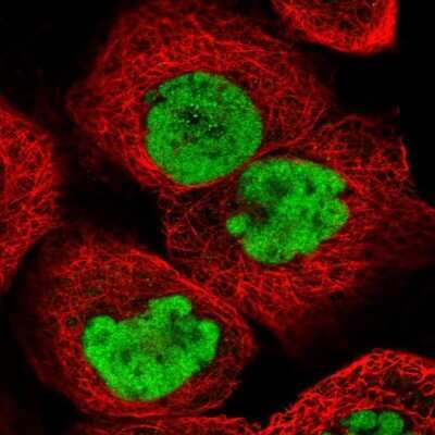 <b>Independent Antibodies Validation. </b>Immunocytochemistry/Immunofluorescence: SCC112 Antibody [NBP2-38313] - Immunofluorescent staining of human cell line A-431 shows localization to nucleoplasm.