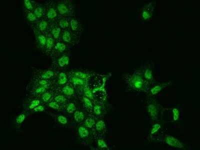 Immunocytochemistry/Immunofluorescence: SCC112 Antibody [NBP2-98627] - Immunofluorescence staining of SCC112 in A431 cells. Cells were fixed with 4% PFA, permeabilzed with 0.1% Triton X-100 in PBS, blocked with 10% serum, and incubated with rabbit anti-Human SCC112 polyclonal antibody (dilution ratio 1:200) at 4C overnight. Then cells were stained with the Alexa Fluor(R)488-conjugated Goat Anti-rabbit IgG secondary antibody (green). Positive staining was localized to Nucleus.