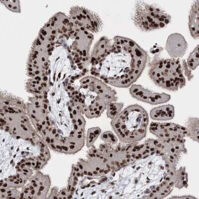 Immunohistochemistry: SCC112 Antibody [NBP2-38313] - Staining of human placenta shows strong nuclear positivity in trophoblastic cells.