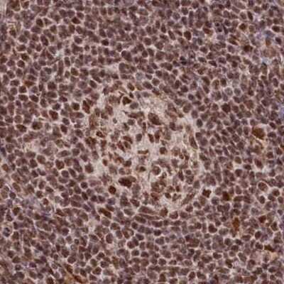 Immunohistochemistry-Paraffin: SCC112 Antibody [NBP1-87904] - Staining of human lymph node.