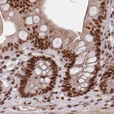 Immunohistochemistry-Paraffin: SCC112 Antibody [NBP1-87904] - Staining of human colon.