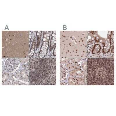 <b>Independent Antibodies Validation. </b>Immunohistochemistry-Paraffin: SCC112 Antibody [NBP2-38313] - Staining of human cerebral cortex, colon, kidney and lymph node using Anti-PDS5A antibody NBP2-38313 (A) shows similar protein distribution across tissues to independent antibody NBP1-87904 (B).