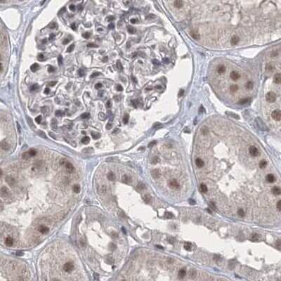 Immunohistochemistry-Paraffin: SCC112 Antibody [NBP2-38313] - Staining of human kidney.