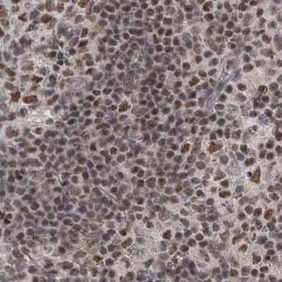 Immunohistochemistry-Paraffin: SCC112 Antibody [NBP2-38313] - Staining of human lymph node.