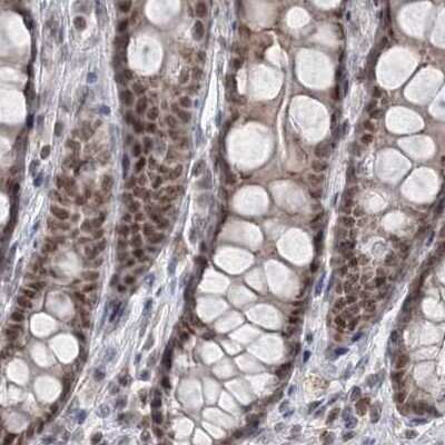 Immunohistochemistry-Paraffin: SCC112 Antibody [NBP2-38313] - Staining of human colon.