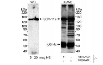 Immunoprecipitation: SCC112 Antibody [NB100-425] - Samples: Nuclear extract (5 and 20 ug for WB, 1 mg for IP) from HeLa cells.  Antibodies: Affinity purified rabbit anti-SCC-112 antibody (NB100-425) used at 0.1 ug/ml for WB and at 2 ug/mg extract for IP or affinity purified rabbit anti-SCC-112 antibody( NB100-426) used at 2 ug/mg extract for IP.  Detection: Chemiluminescence with an exposure time of less than 5 minutes.