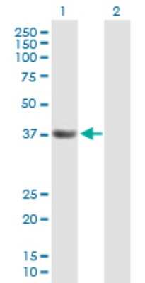 Western Blot: SCC112 Antibody [H00023244-B01P] - Analysis of PDS5A expression in transfected 293T cell line by PDS5A polyclonal antibody.  Lane 1: SCC-112 transfected lysate(36.63 KDa). Lane 2: Non-transfected lysate.