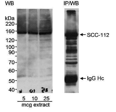 Western Blot: SCC112 Antibody [NB100-426] - Detection of human SCC-112 in Western Blot and immunoprecipitation, using NB100-426.  Samples:  HeLa nuclear extracts.  Exposure time of less than 5 minutes.