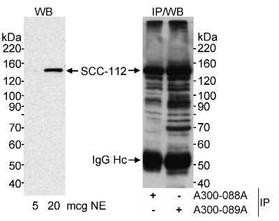 Western Blot SCC112 Antibody