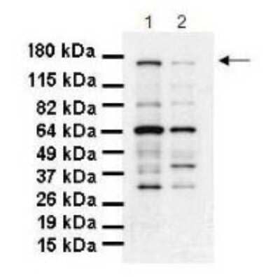 Western Blot: SCC112 Antibody [NBP1-57664] - Human pancreatic cancer cell line MiaPaca-2 and Panc-1, concentration 1 ug/ml.