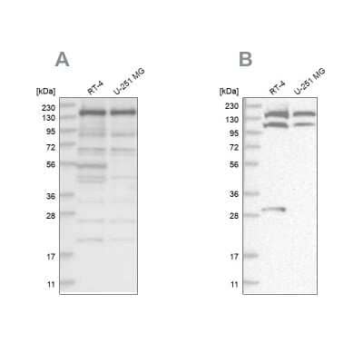 Western Blot: SCC112 Antibody [NBP1-87904] - Analysis using Anti-PDS5A antibody NBP1-87904 (A) shows similar pattern to independent antibody NBP2-38313 (B).