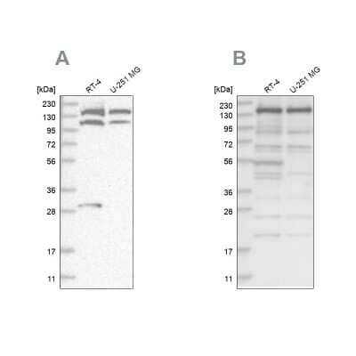 Western Blot SCC112 Antibody