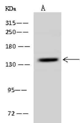 Western Blot: SCC112 Antibody [NBP2-98627] - Anti-SCC112 rabbit polyclonal antibody at 1:500 dilution. Lane A: U-251 MG Whole Cell Lysate Lysates/proteins at 30 ug per lane. Secondary Goat Anti-Rabbit IgG (H+L)/HRP at 1/10000 dilution. Developed using the ECL technique. Performed under reducing conditions. Predicted band size: 150 kDa. Observed band size: 150 kDa