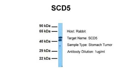 Western Blot: SCD5 Antibody [NBP2-83498] - Host: Rabbit. Target Name: SCD5. Sample Tissue: Human Stomach Tumor. Antibody Dilution: 1.0ug/ml