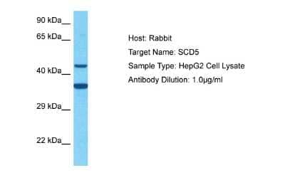 Western Blot: SCD5 Antibody [NBP2-83498] - Host: Rabbit. Target Name: SCD5. Sample Tissue: Human HepG2 Whole Cell. Antibody Dilution: 3ug/ml