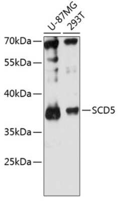 Western Blot: SCD5 Antibody [NBP2-94369] - Analysis of extracts of various cell lines, using SCD5 antibody at 1:3000 dilution.Secondary antibody: HRP Goat Anti-Rabbit IgG (H+L) at 1:10000 dilution.Lysates/proteins: 25ug per lane. Blocking buffer: 3% nonfat dry milk in TBST.Detection: ECL Enhanced Kit. Exposure time: 90s.