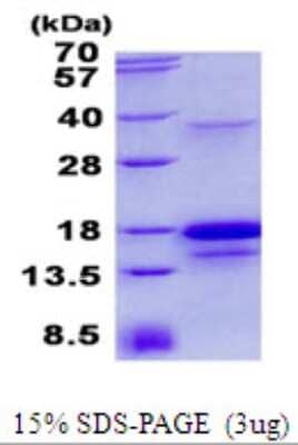 SDS-Page: SCDGFB Protein [NBP2-23335]