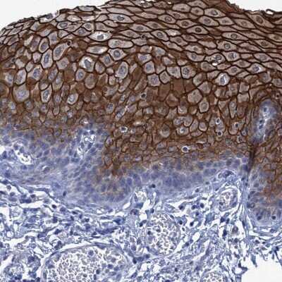 Immunohistochemistry-Paraffin: SCEL Antibody [NBP1-82137] - Staining of human esophagus shows strong membranous positivity in squamous epithelial cells.