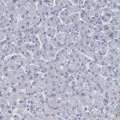 Immunohistochemistry-Paraffin: SCEL Antibody [NBP1-82137] - Staining of human liver shows no positivity in hepatocytes as expected.