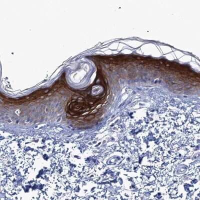 Immunohistochemistry-Paraffin: SCEL Antibody [NBP1-82137] - Staining of human skin shows moderate to strong cytoplasmic and membranous positivity in squamous epithelial cells.