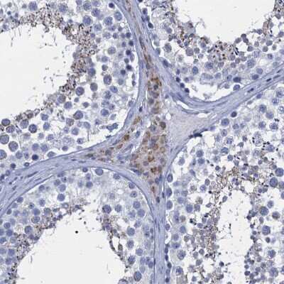 Immunohistochemistry-Paraffin: SCEL Antibody [NBP1-82137] - Staining of human testis shows weak cytoplasmic positivity in Leydig cells.