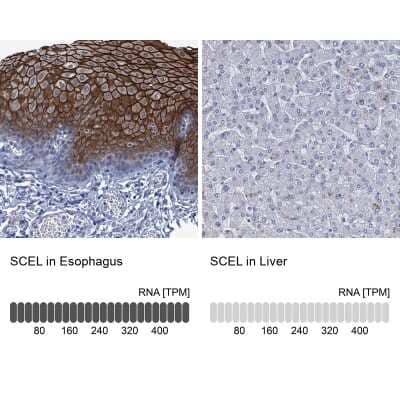 Immunohistochemistry-Paraffin: SCEL Antibody [NBP1-82137] - Staining in human esophagus and liver tissues using NBP1-82137 antibody. Corresponding SCEL RNA-seq data are presented for the same tissues.