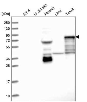 Western Blot: SCEL Antibody [NBP1-82137] - Analysis in human cell line RT-4, human cell line U-251 MG, human plasma, human liver tissue and human tonsil tissue.
