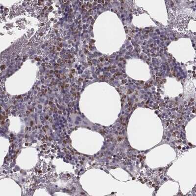 Immunohistochemistry-Paraffin: SCF/c-kit Ligand Antibody [NBP2-57463] - Immunohistochemical staining of human bone marrow shows nuclear positivity in hematopoietic cells.