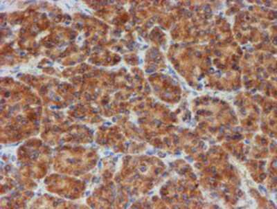 Immunohistochemistry-Paraffin: SCFD1 Antibody (5G4) [NBP2-02031] - Staining of paraffin-embedded Human pancreas tissue using anti-SCFD1 mouse monoclonal antibody.