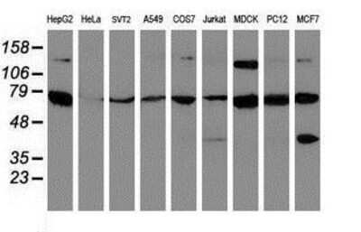 Western Blot: SCFD1 Antibody (5G4) [NBP2-02031] Analysis of extracts (35ug) from 9 different cell lines by usin g anti-SCFD1 monoclonal antibody (HepG2: human; HeLa: human; SVT2: mouse; A549: human; COS7: monkey; Jurkat: human; MDCK: canine; PC12: rat; MCF7: human).