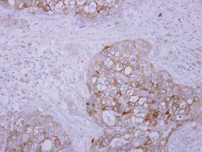 Immunohistochemistry-Paraffin: SCFD1 Antibody [NBP2-20268] - Immunohistochemical analysis of paraffin-embedded J5 xenograft, using antibody at 1:500 dilution.