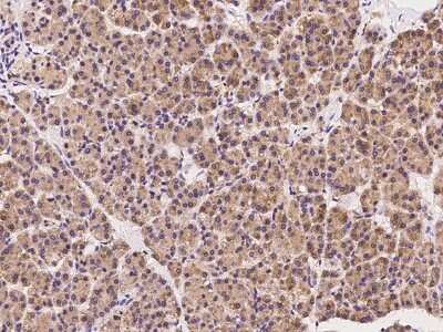 Immunohistochemistry-Paraffin: SCFD1 Antibody [NBP2-97778] - Immunochemical staining of human SCFD1 in human placenta with rabbit polyclonal antibody at 1:100 dilution, formalin-fixed paraffin embedded sections.