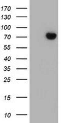 Western Blot: SCFD1 Antibody (OTI5G4) - Azide and BSA Free [NBP2-74004] - HEK293T cells were transfected with the pCMV6-ENTRY control (Left lane) or pCMV6-ENTRY SCFD1 (Right lane) cDNA for 48 hrs and lysed. Equivalent amounts of cell lysates (5 ug per lane) were separated by SDS-PAGE and immunoblotted with anti-SCFD1.