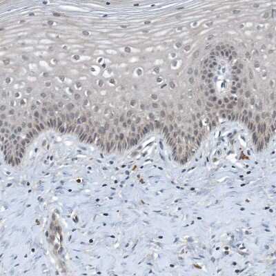 Immunohistochemistry-Paraffin SCFD2 Antibody