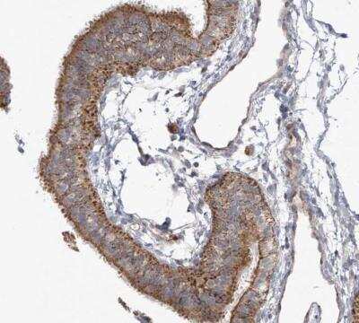 Immunohistochemistry-Paraffin SCGB1D2 Antibody - BSA Free