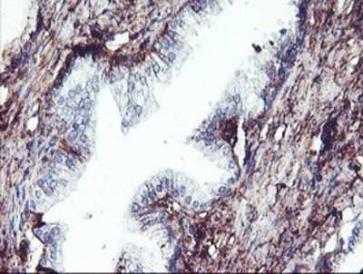 Immunohistochemistry: SCHIP1 Antibody (OTI1C8) - Azide and BSA Free [NBP2-74008] - Staining of paraffin-embedded Human prostate tissue using anti-SCHIP1 mouse monoclonal antibody.