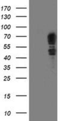 Western Blot: SCHIP1 Antibody (OTI1C8) - Azide and BSA Free [NBP2-74008] - HEK293T cells were transfected with the pCMV6-ENTRY control (Left lane) or pCMV6-ENTRY SCHIP1 (Right lane) cDNA for 48 hrs and lysed. Equivalent amounts of cell lysates (5 ug per lane) were separated by SDS-PAGE and immunoblotted with anti-SCHIP1.