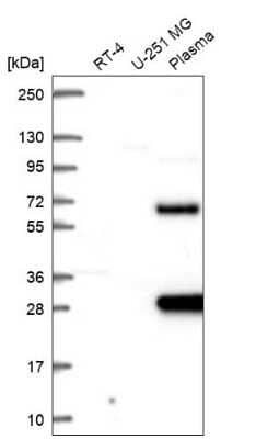 Western Blot: SCHIP1 Antibody [NBP2-68891] - Analysis in human cell line RT-4, human cell line U-251 MG and human plasma.
