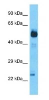 Western Blot: SCHIP1 Antibody [NBP3-09332] - Western blot analysis of SCHIP1 in Lung Tumor lysates. Antibody dilution at 1.0ug/ml