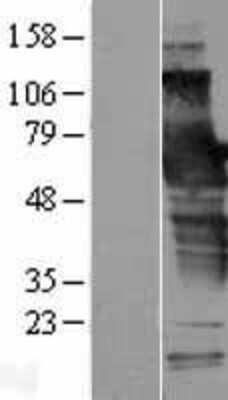 Western Blot SCHIP1 Overexpression Lysate