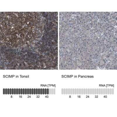 <b>Orthogonal Strategies Validation. </b>Immunohistochemistry-Paraffin: SCIMP Antibody [NBP2-48502] - Staining in human tonsil and pancreas tissues using anti-SCIMP antibody. Corresponding SCIMP RNA-seq data are presented for the same tissues.